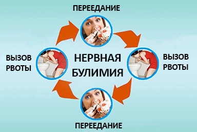 Лечение булимии в Снежинске